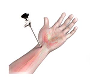 wrist arthroscopy surgery arthroscopic hand bones carpal joint eight complex called supported